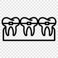 dental braces, orthodontic braces, retainer braces, braces icon svg