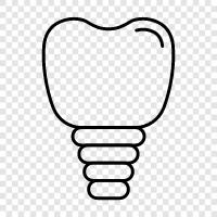 dental implant, dental implant surgery, dental implant cost, dental implant placement icon svg