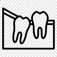 extraction, wisdom teeth removal, removal of wisdom teeth, wisdom teeth icon svg