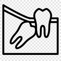 extraction, removal, surgery, wisdom teeth icon svg